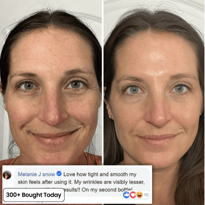 Pinkish Collagen Plump & Repair Balm